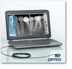 Opteo Intraoral X-ray Sensor