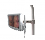 M-968 intraoral camera