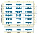 Quattro Intro-Set bridge links,